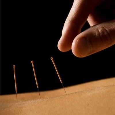 Stay In the Game With Acupuncture