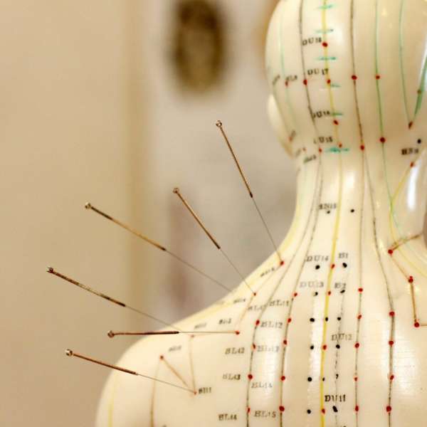 Revive Your Immune System with Acupuncture