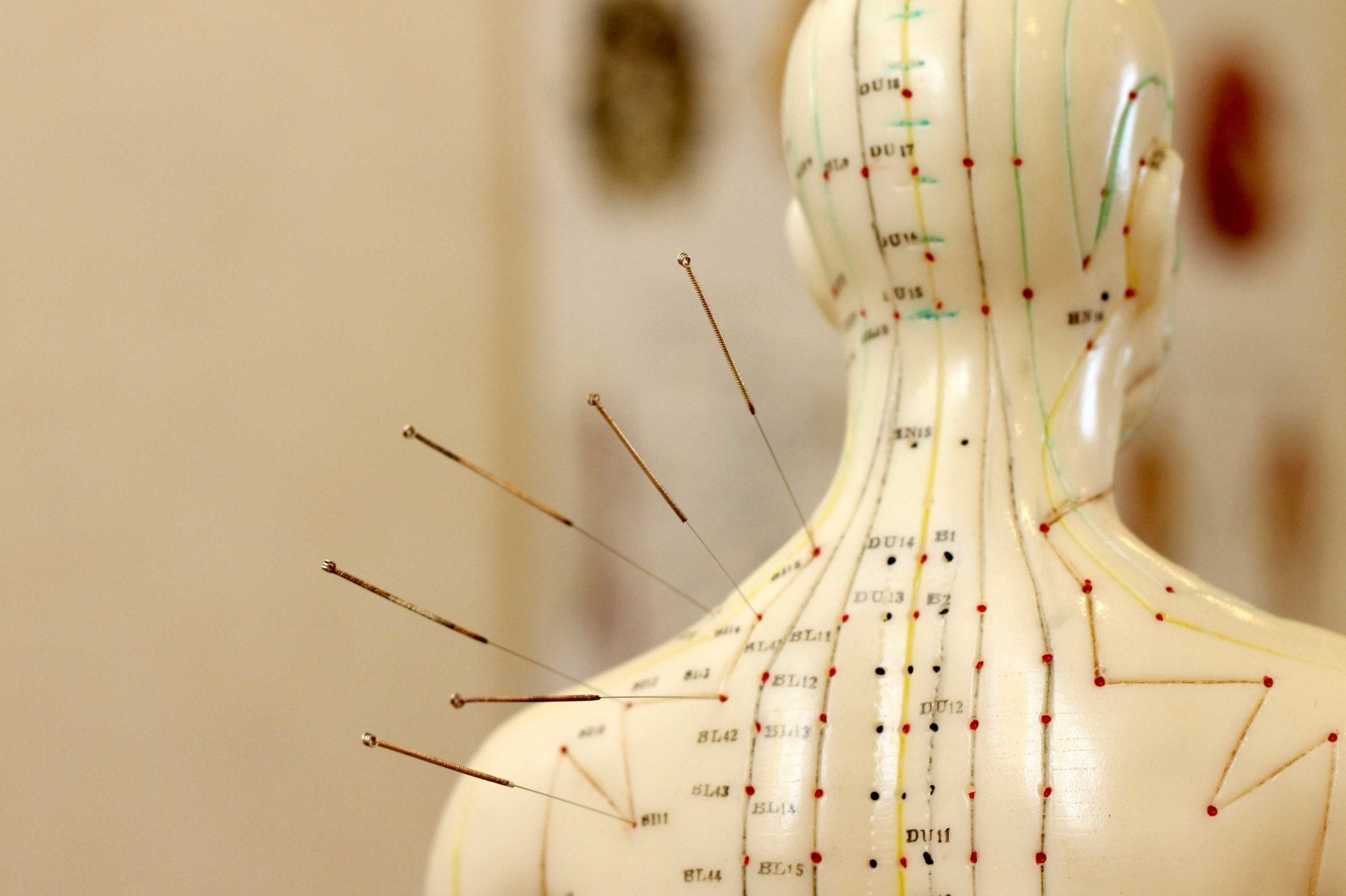 Revive Your Immune System with Acupuncture Fitness Incentive
