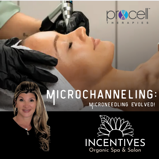 Restore Your Skin with Microchanneling