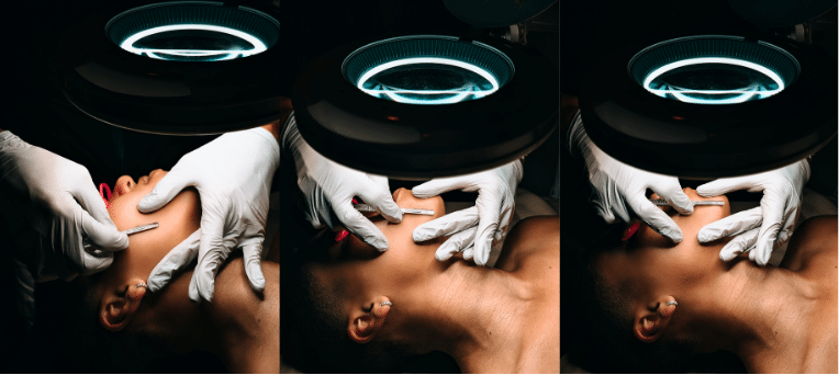 Fall 2025 FTP Top of page alt Dermaplaning