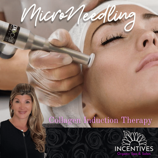 The Beauty of Collagen Induction Therapy