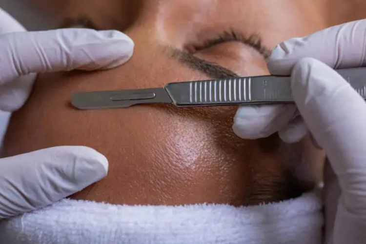 Dermaplaning